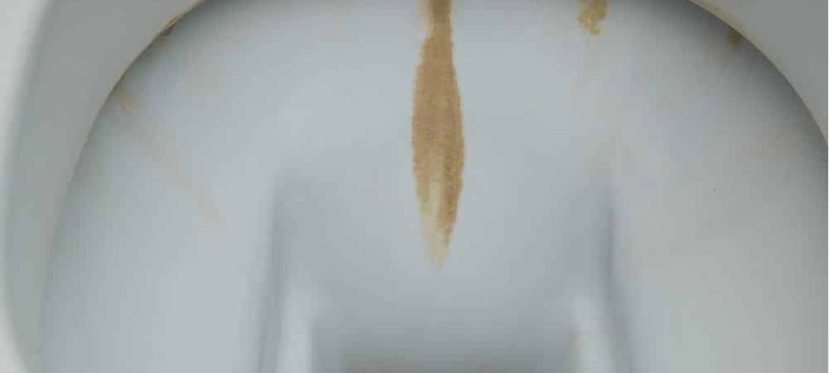 How To Prevent Rust Stains In Your Toilet
