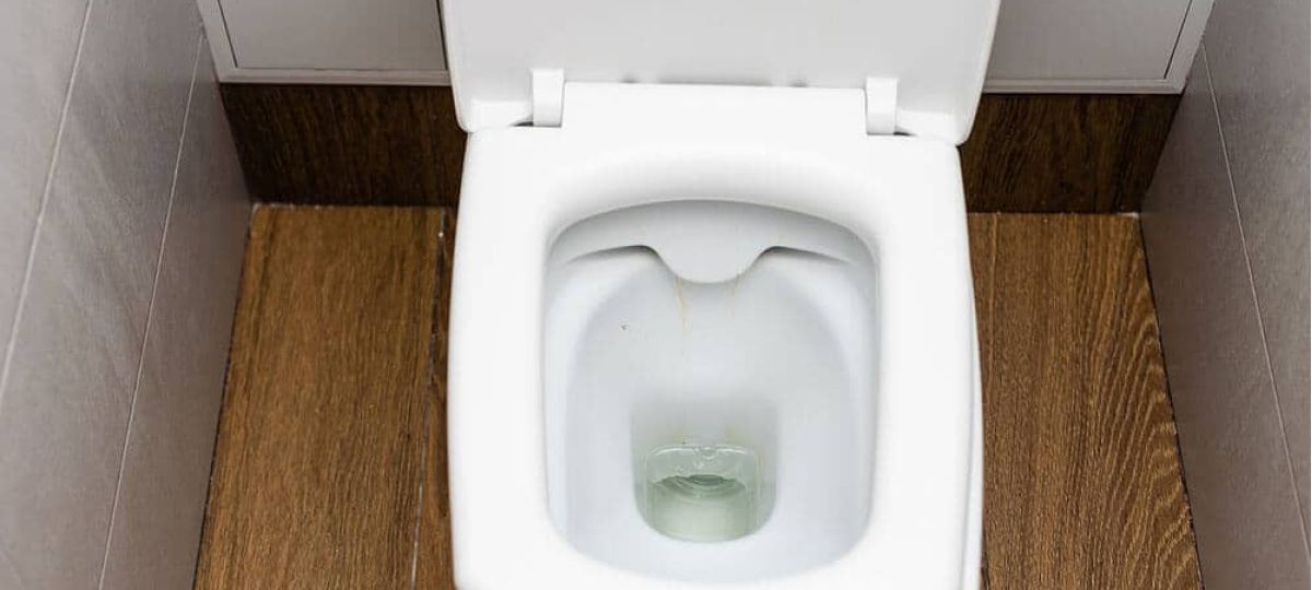 How To Fix A Running Toilet?